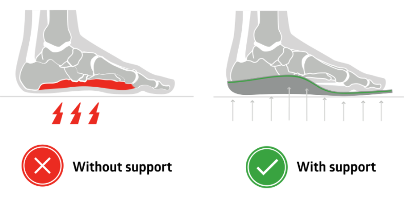 good and bad foot examples, diagram red and green